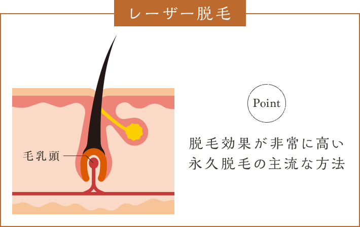 レーザー脱毛